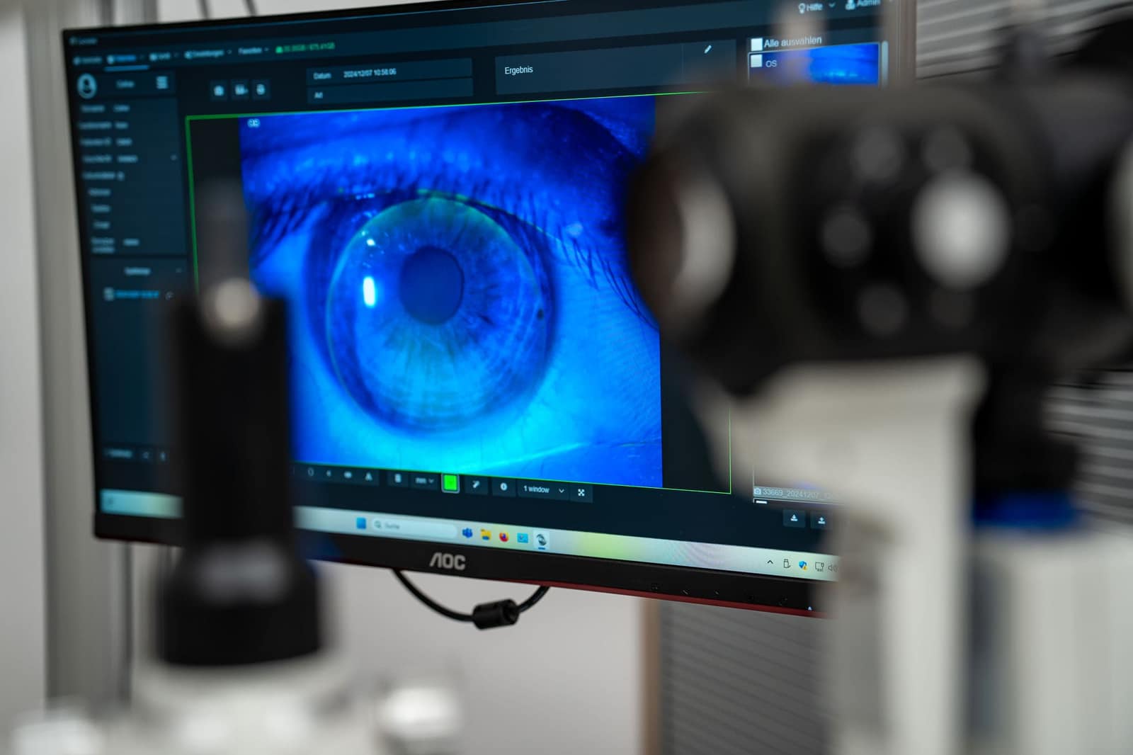 Monitor mit einer vergrößerten Aufnahme des Auges bei der Hornhautanalyse